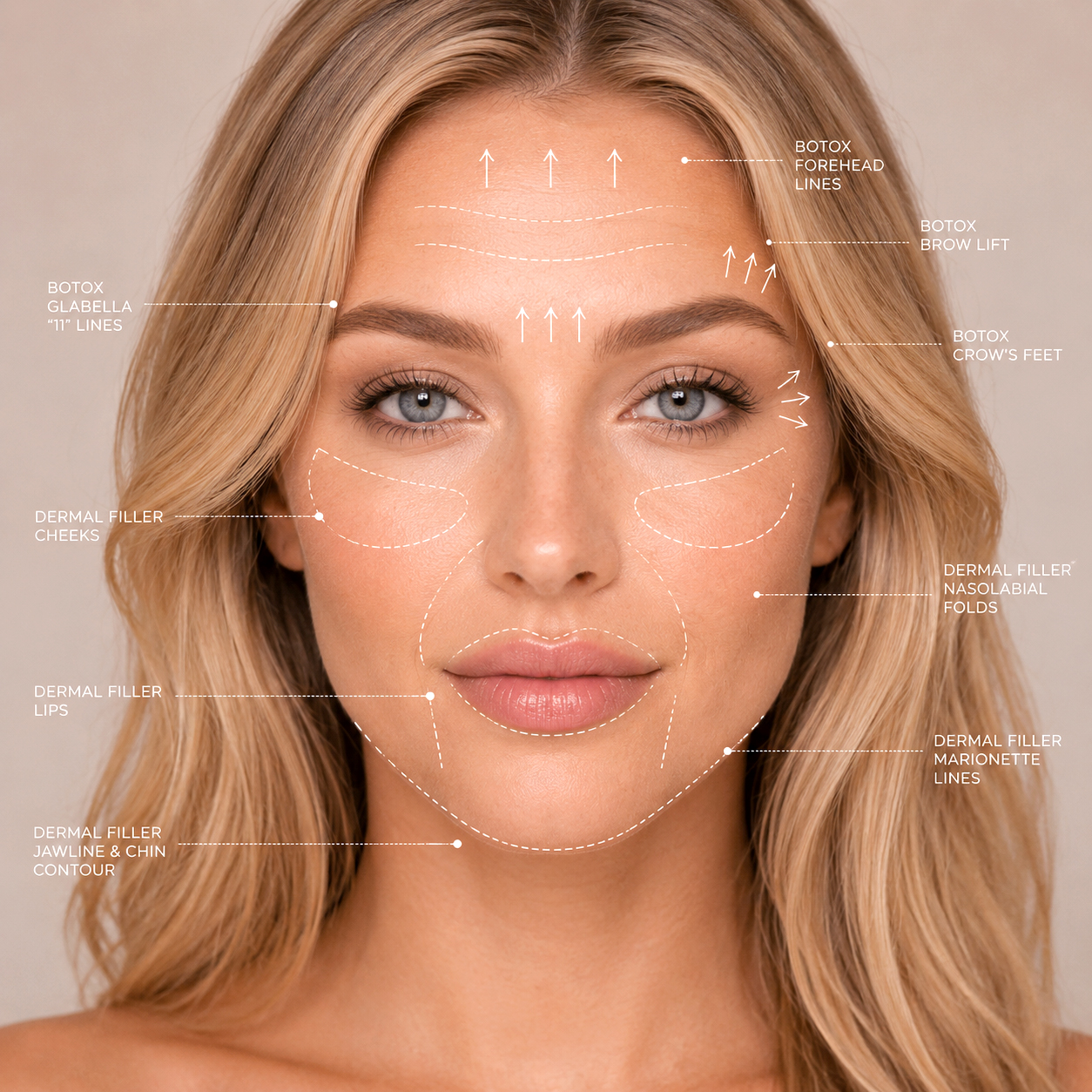Neurotoxins and dermal fillers at Newport Faces