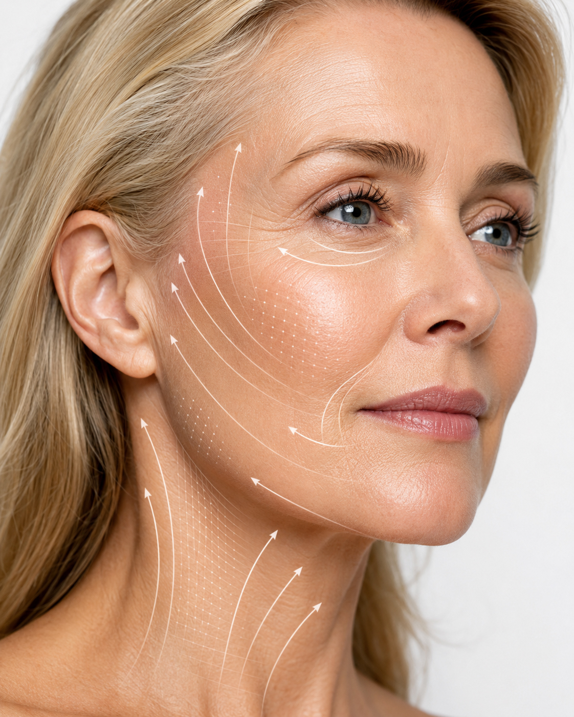 Educational graphic showing how fractional CO2 laser resurfacing may improve mature facial skin