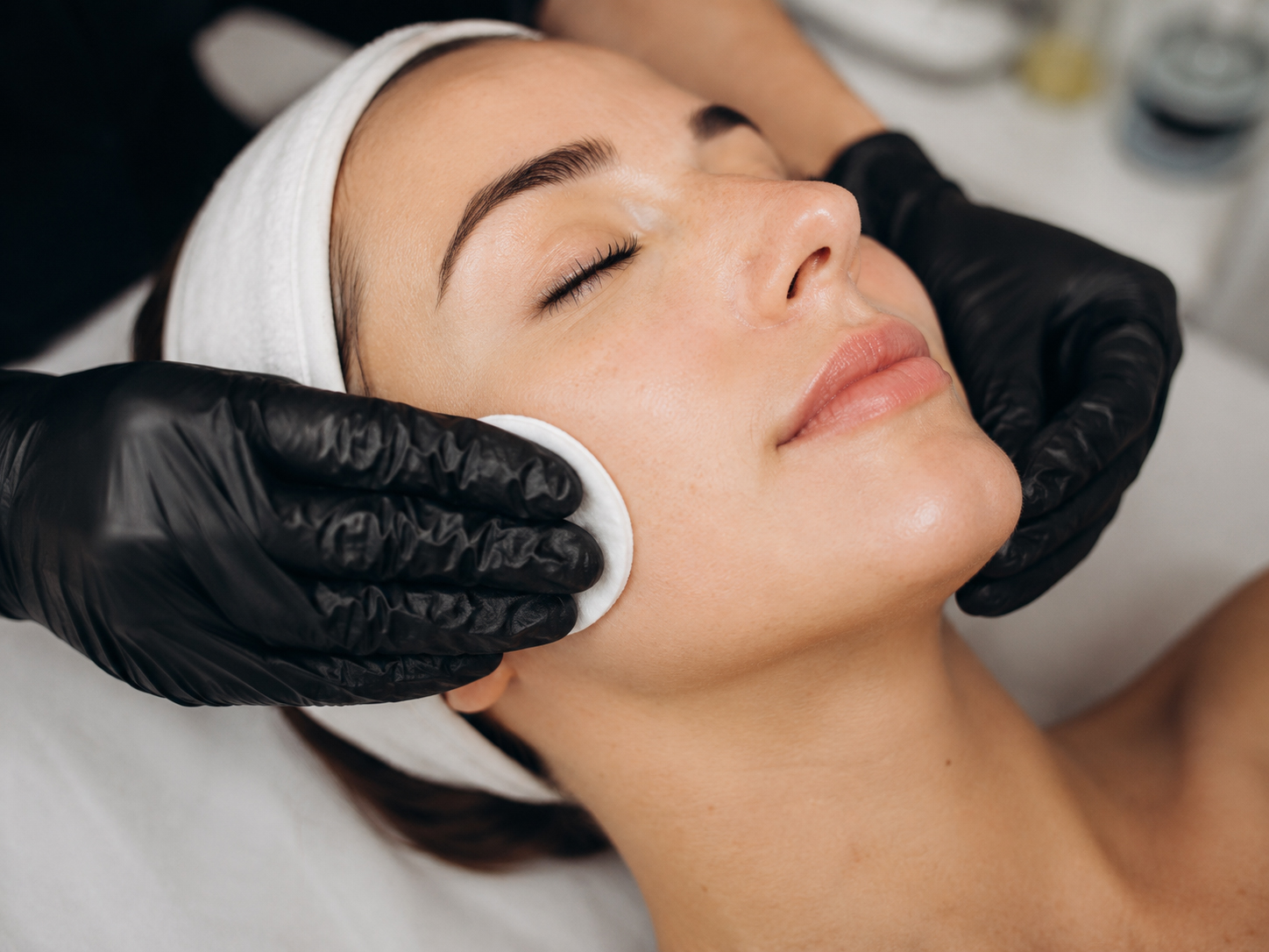 Professional chemical peel treatment performed on a patient at Newport Faces